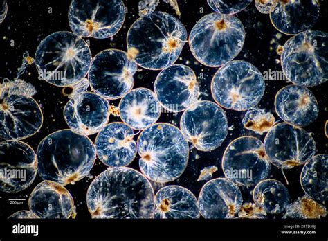  Noctiluca Scintillans:  A Bioluminescent Dinoflagellate That Shines Like Millions of Tiny Stars!